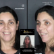 Depoimento de paciente com paralisia facial tratada com ozonioterapia