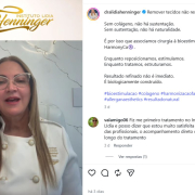 Flacidez facial: por que remover pele não é suficiente (e o que realmente sustenta o resultado)