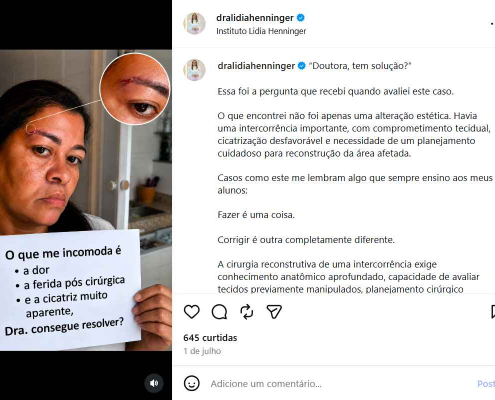 Intercorrências cirúrgicas na face: como o planejamento reconstrutivo pode restaurar função, estética e confiança