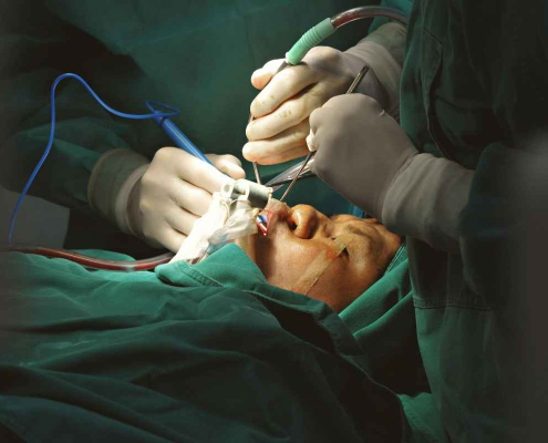 Cirurgia Bucomaxilofacial: por que experiência, anatomia e planejamento fazem diferença na segurança do paciente